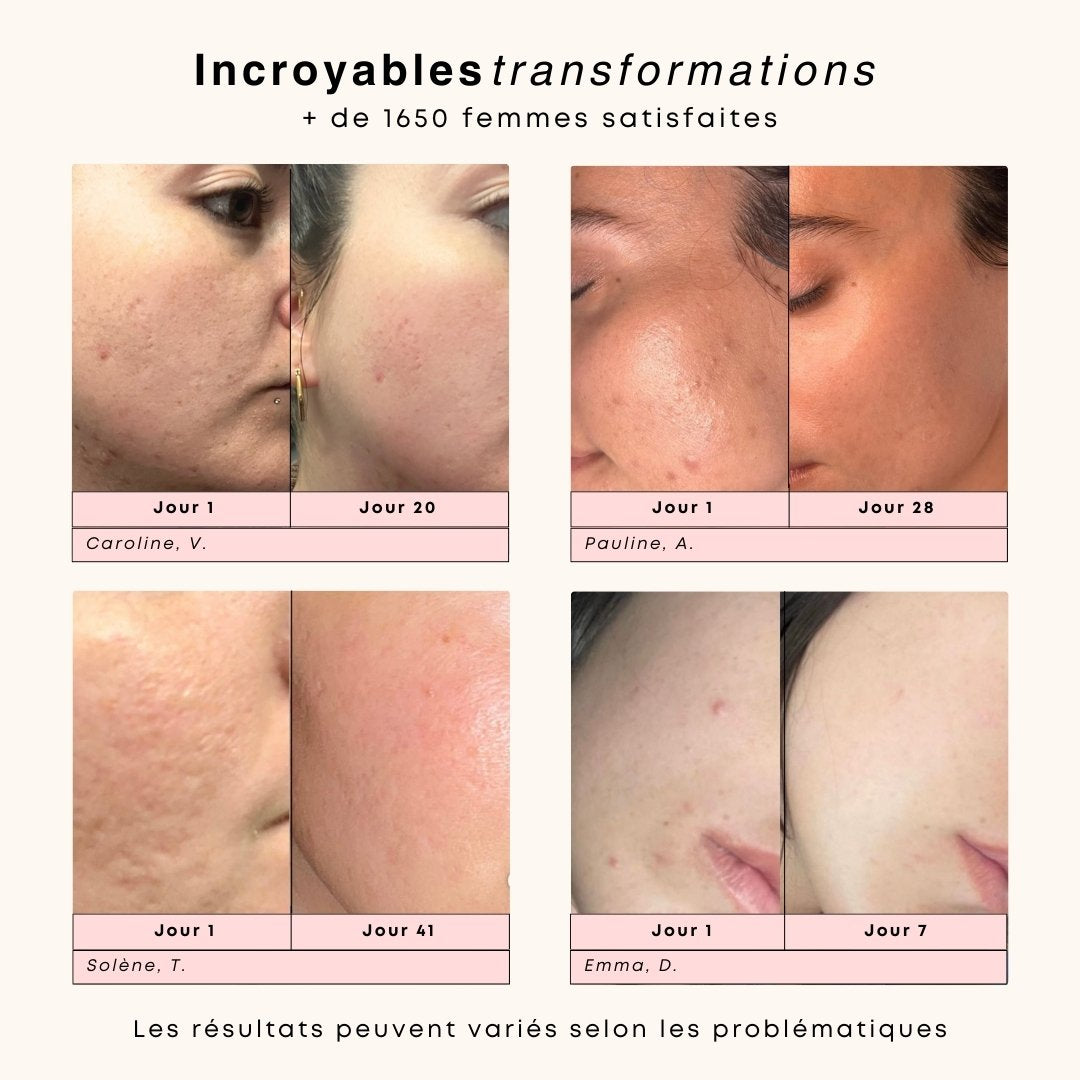 Brosse nettoyante et massante